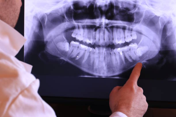Best Emergency Dental Care for Broken or Chipped Teeth in Lake Park, NC
